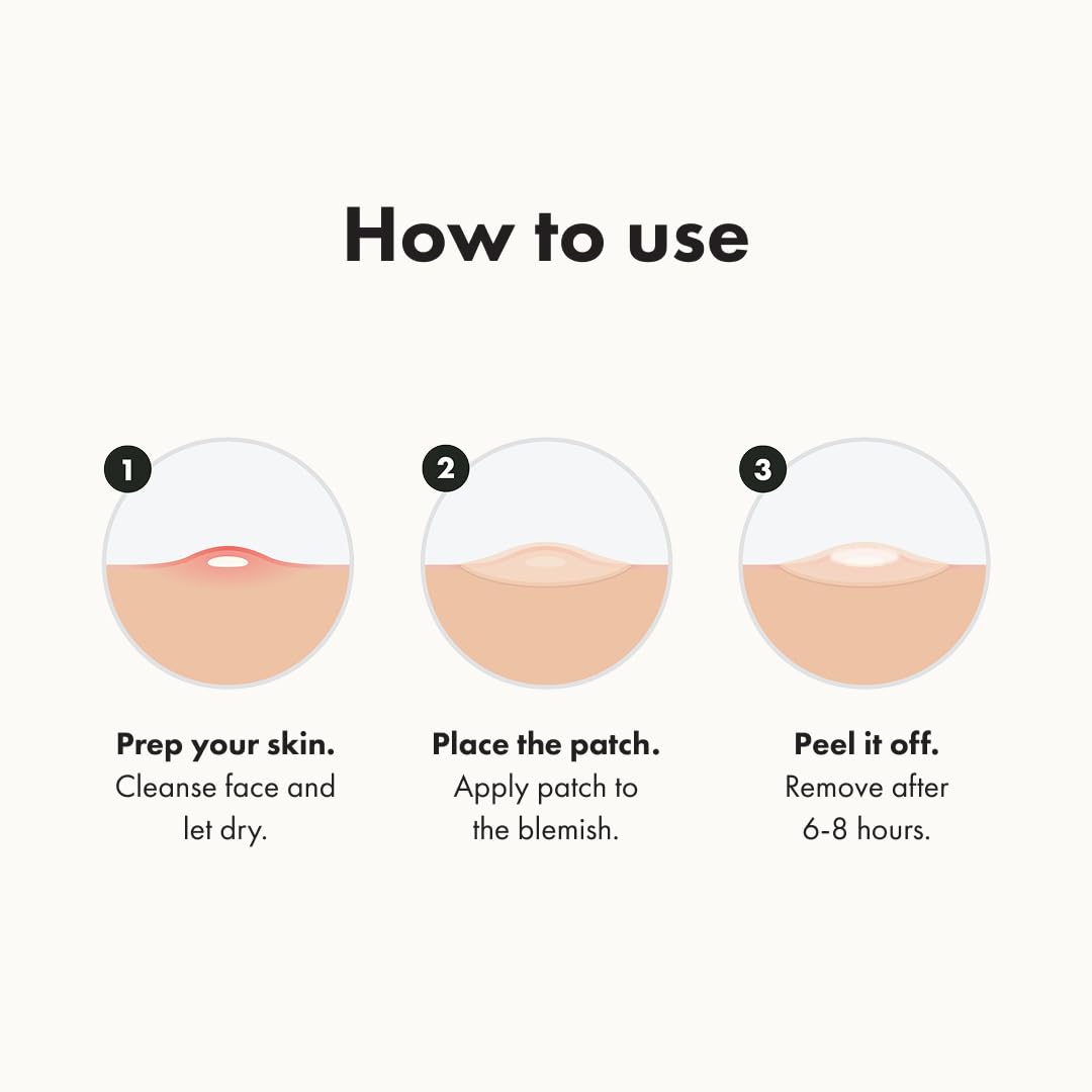 🔥 38% OFF FOR 5 DAYS ONLY! 🔥 | High-efficiency acne patches