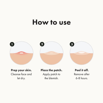 🔥 38% OFF FOR 5 DAYS ONLY! 🔥 | High-efficiency acne patches
