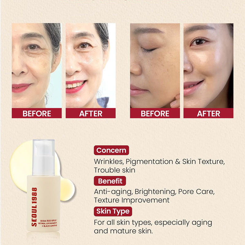 Retinol & Ginseng Brightening Serum ✨ | Dark Spot Corrector for Elbows, Armpits & Face
