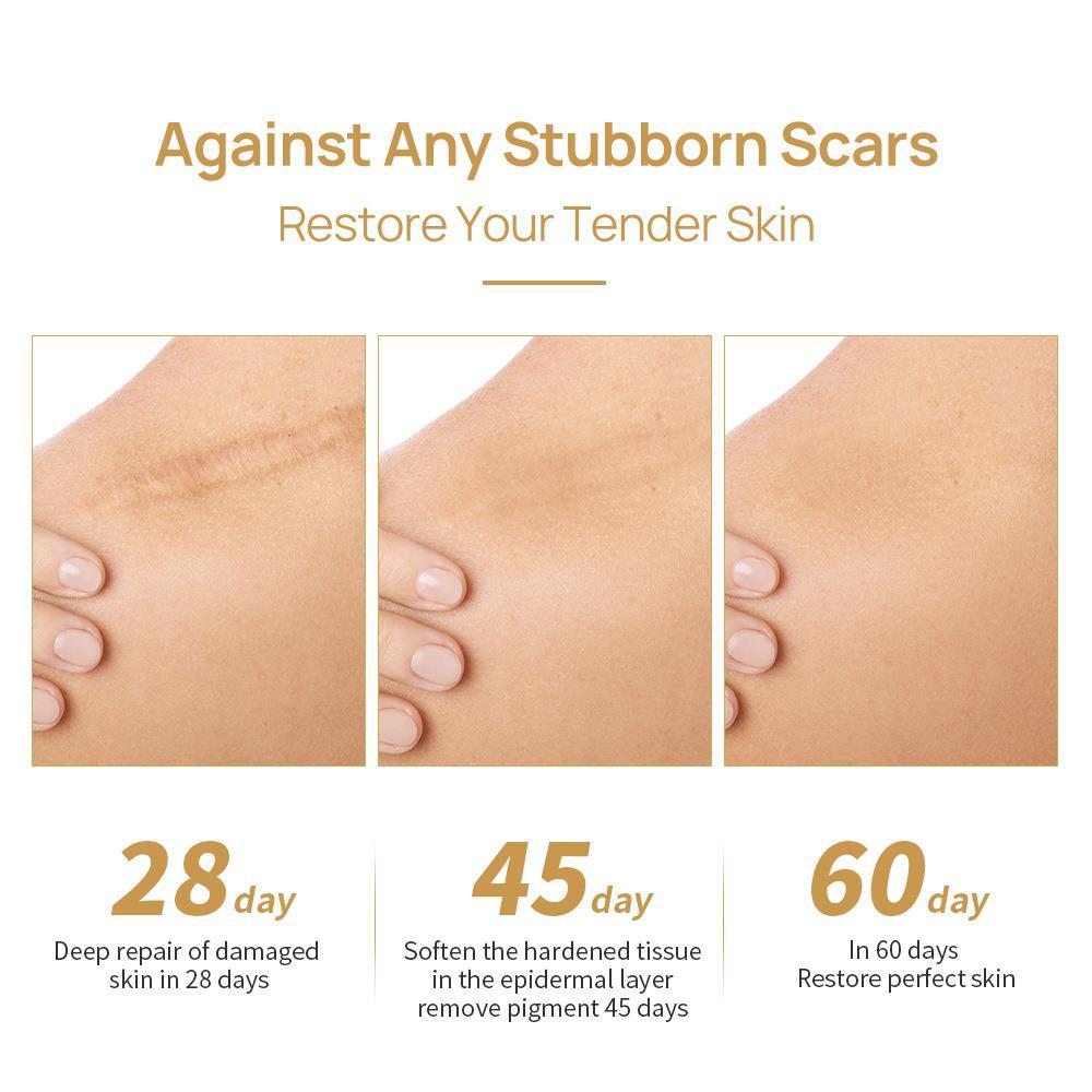 Herbal Scar & Acne Mark Gel 🌿 | Users with acne scars (post-operative scars), stretch marks, etc.