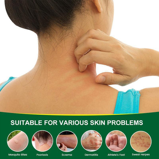 Instant Itch Relief in 15 Seconds! Herbal Repair Itch-Relief Cream, Targeted Relief from Mosquito Bites, Eczema, and Dry Skin Itching